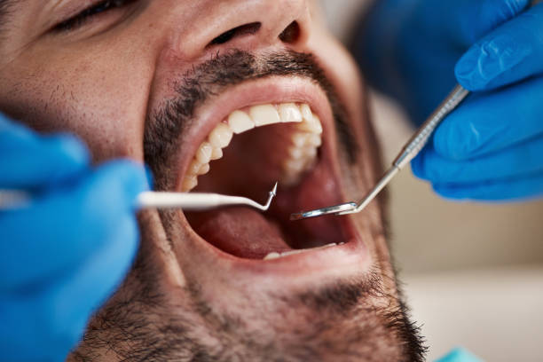 Best Emergency Treatment for Oral Infections in Badin, NC