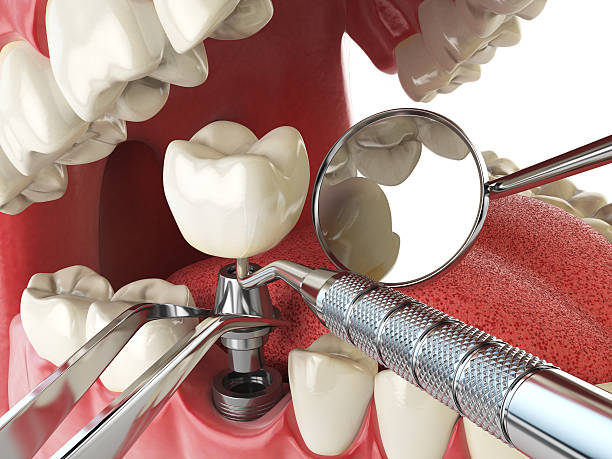Best Emergency Treatment for Jaw Pain or Injury in Badin, NC